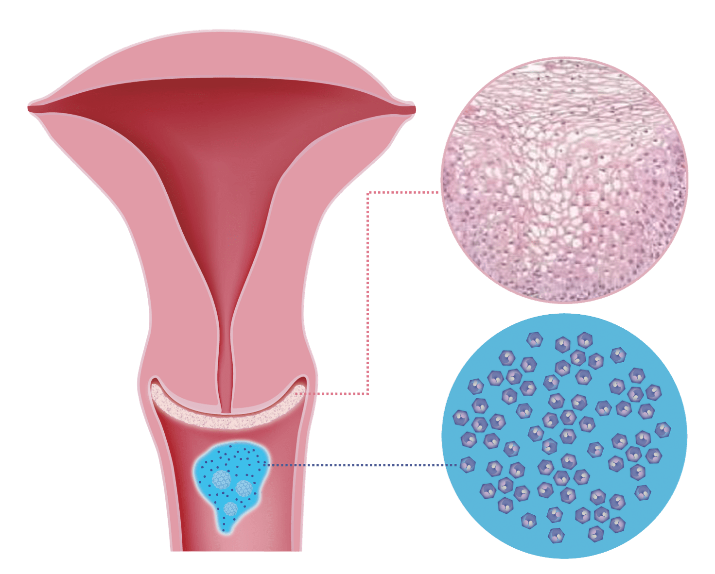 Si funksionon DeflaGyn